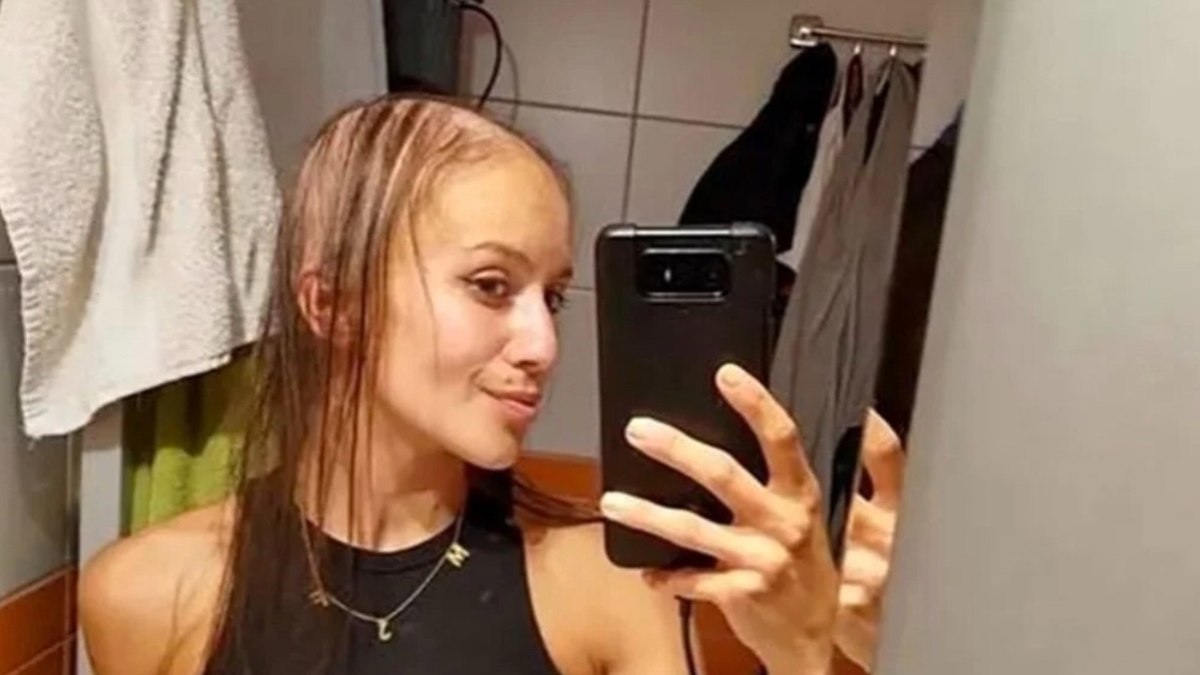 Çekya’da göğüs büyütme ameliyatına girdi: Saçları döküldü